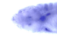 RE07751